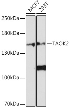 Western blot analysis of extracts of various cell lines, using TAOK2 Rabbit pAb (TA382299) at 1:1000 dilution. - Secondary antibody: HRP Goat Anti-Rabbit IgG (H+L) at 1:10000 dilution. - Lysates/proteins: 25ug per lane. - Blocking buffer: 3% nonfat dry milk in TBST. - Detection: ECL Basic Kit . - Exposure time: 180s.