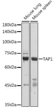 Western blot analysis of extracts of various cell lines, using TAP1 antibody (TA382301) at 1:1000 dilution. - Secondary antibody: HRP Goat Anti-Rabbit IgG (H+L) at 1:10000 dilution. - Lysates/proteins: 25ug per lane. - Blocking buffer: 3% nonfat dry milk in TBST. - Detection: ECL Basic Kit . - Exposure time: 10s.