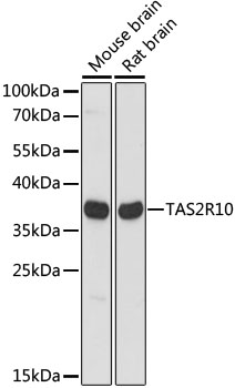 Western blot analysis of extracts of various cell lines, using TAS2R10 antibody (TA382316) at 1:1000 dilution. - Secondary antibody: HRP Goat Anti-Rabbit IgG (H+L) at 1:10000 dilution. - Lysates/proteins: 25ug per lane. - Blocking buffer: 3% nonfat dry milk in TBST. - Detection: ECL Basic Kit . - Exposure time: 5s.