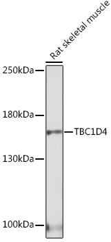 Immunoprecipitation of human CD9 from the biotin-labeled human platelets lysates. Lane 1: immunoprecipitation with anti-CD9 (IVA50). Lane 2: immunoprecipitation with anti-human CD9 control antibody. Lane 3: immunoprecipitation with negative control.