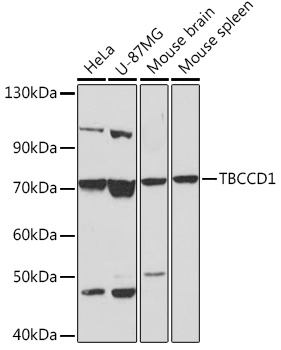 Western blot analysis of extracts of various cell lines, using TBCCD1 Rabbit pAb (TA382338) at 1:1000 dilution. - Secondary antibody: HRP Goat Anti-Rabbit IgG (H+L) at 1:10000 dilution. - Lysates/proteins: 25ug per lane. - Blocking buffer: 3% nonfat dry milk in TBST. - Detection: ECL Basic Kit . - Exposure time: 60s.