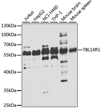 Dot Blot analysis of recombinant HIV protease. The total amount of recombinant HIV-protease spotted on the Nitrocell ulose membrane are indicated in left column. Lane 1: Anti-HIV Protease (Clone 1696) at 0.2 g/ml. Lane 2: Anti-HIV Protease (Clone 1696) at 1