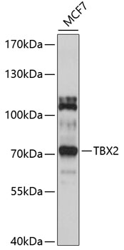Western blot ofpurified horse radish peroxidase sample; non-reduced sample, immunostained bymAbHP-03and anti-goat anti-mouse IgG (H+L)-HRPconj ugate.