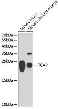 Surface staining of Human peripheral blood cells with anti-Human IgM Antibody (CH2) APC conjuagetd Cat.-No SM3063APC. Cells in the lymphocyte gate were used for analysis.