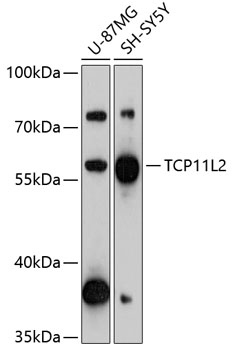 Western blot analysis of extracts of various cell lines, using TCP11L2 antibody (TA382383) at 1:3000 dilution. - Secondary antibody: HRP Goat Anti-Rabbit IgG (H+L) at 1:10000 dilution. - Lysates/proteins: 25ug per lane. - Blocking buffer: 3% nonfat dry milk in TBST. - Detection: ECL Basic Kit . - Exposure time: 90s.