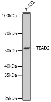 Surface staining of human peripheral blood cells with anti-CD22 (MEM-01) PE. Cells in the lymphocyte gate were used for analysis.