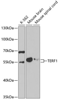 Surface staining of human peripheral blood lymphocytes using anti-human CD8 (clone MEM-31) PE