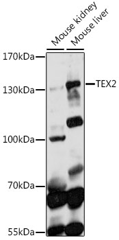 Western blot analysis of extracts of various cell lines, using TEX2 antibody (TA382443) at 1:1000 dilution. - Secondary antibody: HRP Goat Anti-Rabbit IgG (H+L) at 1:10000 dilution. - Lysates/proteins: 25ug per lane. - Blocking buffer: 3% nonfat dry milk in TBST. - Detection: ECL Basic Kit . - Exposure time: 90s.
