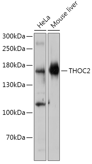 Western blot analysis of extracts of various cell lines, using THOC2 antibody (TA382503) at 1:1000 dilution. - Secondary antibody: HRP Goat Anti-Rabbit IgG (H+L) at 1:10000 dilution. - Lysates/proteins: 25ug per lane. - Blocking buffer: 3% nonfat dry milk in TBST. - Detection: ECL Basic Kit . - Exposure time: 30s.