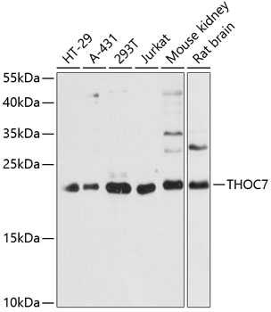 Isolation of Glutathione-S-Transferase (GST) overexpressed in E. coli. Western blot was immunostained by anti-GST (S-tag-05). Lane 1: affinity purification of GST from bacterial cell lysate using commercial sorbent Glutathione-Sepharose Lane 2: affinity purification of GST from bacterial cell lysate using immunosorbent prepared from anti-GST (S-tag-02)
