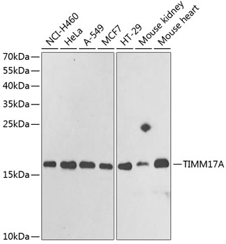Western blot analysis of extracts of various cell lines, using TIMM17A antibody (TA382535) at 1:1000 dilution. - Secondary antibody: HRP Goat Anti-Rabbit IgG (H+L) at 1:10000 dilution. - Lysates/proteins: 25ug per lane. - Blocking buffer: 3% nonfat dry milk in TBST. - Detection: ECL Basic Kit . - Exposure time: 90s.