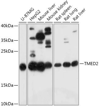 Immunohistochemistry: Alpha Tub ulin antibody staining of Formalin-Fixed, Paraffin-Embedded Human Brain, Cortex followed by biotinylated secondary antibody, alkaline phosphatase-streptavidin and chromogen.