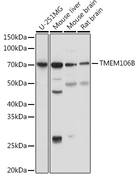 Western blot analysis of extracts of various cell lines, using TMEM106B antibody (TA382595) at 1:1000 dilution. - Secondary antibody: HRP Goat Anti-Rabbit IgG (H+L) at 1:10000 dilution. - Lysates/proteins: 25ug per lane. - Blocking buffer: 3% nonfat dry milk in TBST. - Detection: ECL Basic Kit . - Exposure time: 5s.