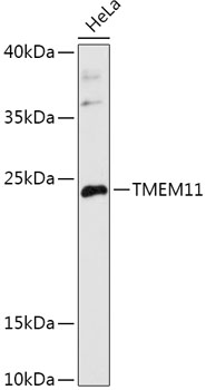 Western blot analysis of extracts of HeLa cells, using TMEM11 antibody (TA382596) at 1:1000 dilution. - Secondary antibody: HRP Goat Anti-Rabbit IgG (H+L) at 1:10000 dilution. - Lysates/proteins: 25ug per lane. - Blocking buffer: 3% nonfat dry milk in TBST. - Detection: ECL Basic Kit . - Exposure time: 3min.