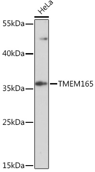 Western blot analysis of extracts of HeLa cells, using TMEM165 Rabbit pAb (TA382601) at 1:1000 dilution. - Secondary antibody: HRP Goat Anti-Rabbit IgG (H+L) at 1:10000 dilution. - Lysates/proteins: 25ug per lane. - Blocking buffer: 3% nonfat dry milk in TBST. - Detection: ECL Enhanced Kit . - Exposure time: 5min.