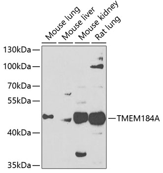 Western blot analysis of extracts of various cell lines, using TMEM184A antibody (TA382605) at 1:1000 dilution._Secondary antibody: HRP Goat Anti-Rabbit IgG (H+L) at 1:10000 dilution._Lysates/proteins: 25ug per lane._Blocking buffer: 3% nonfat dry milk in TBST._Detection: ECL Enhanced Kit ._Exposure time: 90s.