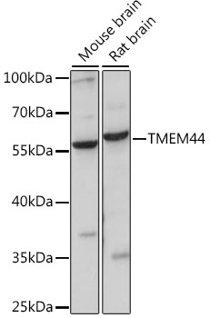 Western blot analysis of extracts of various cell lines, using TMEM44 antibody (TA382611) at 1:1000 dilution. - Secondary antibody: HRP Goat Anti-Rabbit IgG (H+L) at 1:10000 dilution. - Lysates/proteins: 25ug per lane. - Blocking buffer: 3% nonfat dry milk in TBST. - Detection: ECL Basic Kit . - Exposure time: 30s.