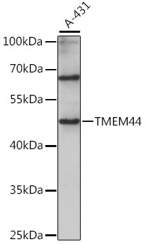 Western blot analysis of extracts of A-431 cells, using TMEM44 antibody (TA382612) at 1:1000 dilution. - Secondary antibody: HRP Goat Anti-Rabbit IgG (H+L) at 1:10000 dilution. - Lysates/proteins: 25ug per lane. - Blocking buffer: 3% nonfat dry milk in TBST. - Detection: ECL Basic Kit . - Exposure time: 30s.