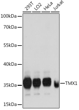 Recombinant hGH and 20kDa hGH were resolved by electrophoresis, transferred to PVDF membrane and probed with anti-hGH (1:500). Proteins were visualized using a goat anti-mouse secondary antibody conj ugated to HRP and a DAB detection system. Arrows indicate recombinant hGH (22kDa) and 20kDa hGH, respectively.