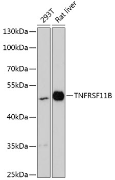 Western blot analysis of extracts of various cell lines, using TNFRSF11B antibody (TA382646) at 1:3000 dilution. - Secondary antibody: HRP Goat Anti-Rabbit IgG (H+L) at 1:10000 dilution. - Lysates/proteins: 25ug per lane. - Blocking buffer: 3% nonfat dry milk in TBST. - Detection: ECL Enhanced Kit . - Exposure time: 90s.