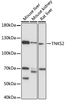 Western Blot of acid extracts from HeLa cells untreated (-) or treated with sodium butyrate (+), using anti-H3K36ac antibody at 1 ug/mL, showed a band of histone H3 acetylated at Lysine 36 in treated HeLa.