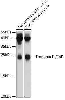 Western Blot of acid extracts from HeLa cells untreated (-) or treated (+) with sodium butyrate, using anti-H3K18ac antibody at 0.5 ug/mL, showed a band of histone H3 acetylated at Lysine 18 in treated HeLa.