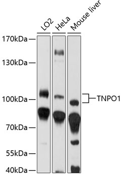 Western blot of serum-starved A431 cells nontreated or treated with EGF, using anti-Phosphotyrosine antibody at 1/5000 dilution. The blot was exposed to films at different time points.