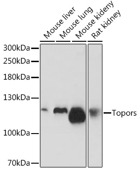 Western blot analysis of extracts of various cell lines, using Topors Rabbit pAb (TA382713) at 1:1000 dilution. - Secondary antibody: HRP Goat Anti-Rabbit IgG (H+L) at 1:10000 dilution. - Lysates/proteins: 25ug per lane. - Blocking buffer: 3% nonfat dry milk in TBST. - Detection: ECL Basic Kit . - Exposure time: 3min.