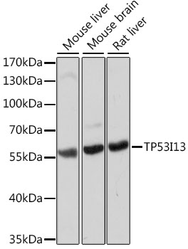Western blot analysis of extracts of various cell lines, using TP53I13 antibody (TA382736) at 1:1000 dilution. - Secondary antibody: HRP Goat Anti-Rabbit IgG (H+L) at 1:10000 dilution. - Lysates/proteins: 25ug per lane. - Blocking buffer: 3% nonfat dry milk in TBST. - Detection: ECL Basic Kit . - Exposure time: 10s.