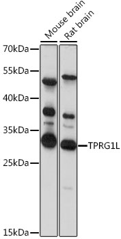 Western blot analysis of extracts of various cell lines, using TPRG1L antibody (TA382763) at 1:1000 dilution. - Secondary antibody: HRP Goat Anti-Rabbit IgG (H+L) at 1:10000 dilution. - Lysates/proteins: 25ug per lane. - Blocking buffer: 3% nonfat dry milk in TBST. - Detection: ECL Basic Kit . - Exposure time: 20s.