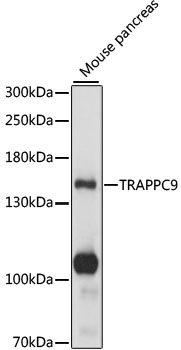 Western blot analysis of extracts of mouse pancreas, using TRAPPC9 antibody (TA382791) at 1:1000 dilution. - Secondary antibody: HRP Goat Anti-Rabbit IgG (H+L) at 1:10000 dilution. - Lysates/proteins: 25ug per lane. - Blocking buffer: 3% nonfat dry milk in TBST. - Detection: ECL Basic Kit . - Exposure time: 1s.