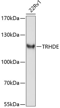 Western blot analysis of extracts of 22Rv1 cells, using TRHDE antibody (TA382799) at 1:1000 dilution. - Secondary antibody: HRP Goat Anti-Rabbit IgG (H+L) at 1:10000 dilution. - Lysates/proteins: 25ug per lane. - Blocking buffer: 3% nonfat dry milk in TBST. - Detection: ECL Enhanced Kit . - Exposure time: 90s.