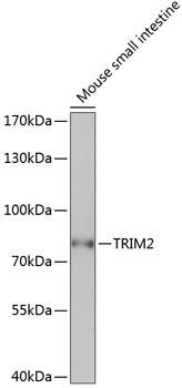 Western blot analysis of extracts of mouse small intestine, using TRIM2 antibody (TA382807) at 1:1000 dilution. - Secondary antibody: HRP Goat Anti-Rabbit IgG (H+L) at 1:10000 dilution. - Lysates/proteins: 25ug per lane. - Blocking buffer: 3% nonfat dry milk in TBST. - Detection: ECL Basic Kit . - Exposure time: 3s.