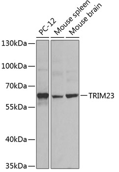 Western blot - Protein Phosphatase 1 beta antibody [EP1804Y]; Anti-Protein Phosphatase 1 beta antibody [EP1804Y] at 1/200000 dilution + Jurkat cell lysate at 10 ug.Secondary.Goat anti-rabbit HRP labeled at 1/2000 dilution.Predicted band size : 37 kDa.Observed band size : 37 kDa.