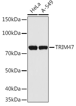 Western blot analysis of extracts of various cell lines, using TRIM47 antibody (TA382830) at 1:1000 dilution. - Secondary antibody: HRP Goat Anti-Rabbit IgG (H+L) at 1:10000 dilution. - Lysates/proteins: 25ug per lane. - Blocking buffer: 3% nonfat dry milk in TBST. - Detection: ECL Basic Kit . - Exposure time: 30s.