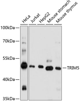 Western Blot: HIF-1 beta Antibody (H1beta234)TA301443 - Analysis of HIF-1 beta in HeLa nuclear extract.