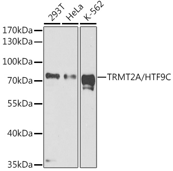 Western blot analysis of extracts of various cell lines, using TRMT2A/HTF9°C antibody (TA382850) at 1:1000 dilution. - Secondary antibody: HRP Goat Anti-Rabbit IgG (H+L) at 1:10000 dilution. - Lysates/proteins: 25ug per lane. - Blocking buffer: 3% nonfat dry milk in TBST. - Detection: ECL Enhanced Kit . - Exposure time: 90s.