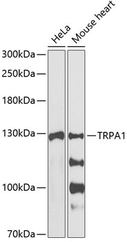 Western blot - muscle Actin antibody [EP184E]; Anti-muscle Actin antibody [EP184E] at 1/1000 dilution + A431 cell lysate at 10 ug/lane.Secondary.Goat anti-rabbit, HRP labelled. at 1/2000 dilution.Predicted band size : 42 kDa.Observed band size : 42 kDa.