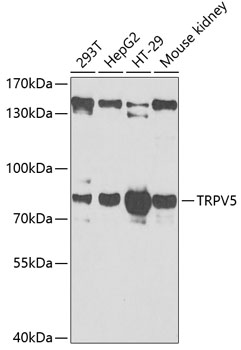 Western blot analysis of extracts of various cell lines, using TRPV5 antibody (TA382878) at 1:1000 dilution. - Secondary antibody: HRP Goat Anti-Rabbit IgG (H+L) at 1:10000 dilution. - Lysates/proteins: 25ug per lane. - Blocking buffer: 3% nonfat dry milk in TBST. - Detection: ECL Basic Kit . - Exposure time: 90s.