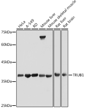 Western blot analysis of extracts of various cell lines, using TRUB1 antibody (TA382881) at 1:500 dilution. - Secondary antibody: HRP Goat Anti-Rabbit IgG (H+L) at 1:10000 dilution. - Lysates/proteins: 25ug per lane. - Blocking buffer: 3% nonfat dry milk in TBST. - Detection: ECL Basic Kit . - Exposure time: 30s.