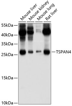 Western blot analysis of extracts of various cell lines, using TSPAN4 antibody (TA382904) at 1:1000 dilution. - Secondary antibody: HRP Goat Anti-Rabbit IgG (H+L) at 1:10000 dilution. - Lysates/proteins: 25ug per lane. - Blocking buffer: 3% nonfat dry milk in TBST. - Detection: ECL Basic Kit . - Exposure time: 15s.