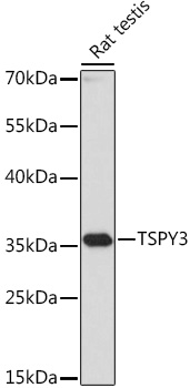 Western blot analysis of extracts of Rat testis, using TSPY3 antibody (TA382909) at 1:1000 dilution. - Secondary antibody: HRP Goat Anti-Rabbit IgG (H+L) at 1:10000 dilution. - Lysates/proteins: 25ug per lane. - Blocking buffer: 3% nonfat dry milk in TBST. - Detection: ECL Basic Kit . - Exposure time: 1s.