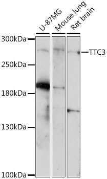 Western blot analysis of extracts of various cell lines, using TTC3 antibody (TA382920) at 1:1000 dilution. - Secondary antibody: HRP Goat Anti-Rabbit IgG (H+L) at 1:10000 dilution. - Lysates/proteins: 25ug per lane. - Blocking buffer: 3% nonfat dry milk in TBST. - Detection: ECL Enhanced Kit . - Exposure time: 3min.