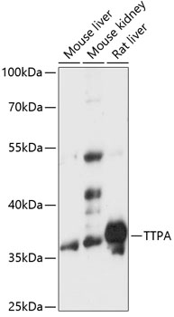 Western blot of rat cortex lysate showing specific immunolableing of the ~ 200k NF-H protein.