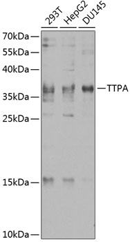 Western blot of rat cortex lysate showing specific immunolableing of the ~ 68k NF-L protein.