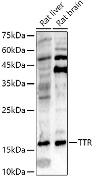 Western blot of rat cortex lysate showing specific immunolableing of the ~ 145k NF-M protein.