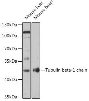 Western blot of rat cerebellar lysate showing specific immunolabeling of the ~ 57k peripherin protein.