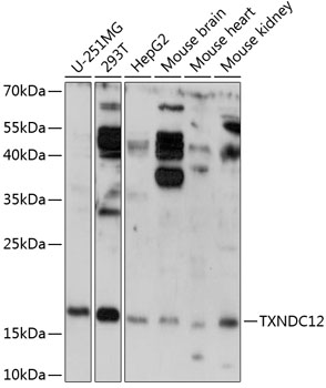 Western blot analysis of Hsp40 YDJ1 in a human cell line mix using a 1:1000 dilution of TA309369.