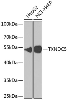 Western blot analysis of Hsp40 YDJ1 in recombinant yeast hsp40 using a 1:1000 dilution of anti-Hsp40.