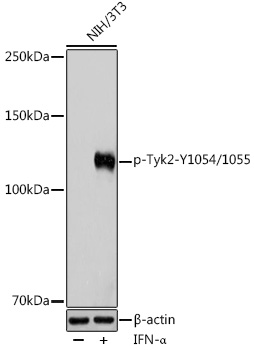Western blot analysis of KDEL in rat tissue lysate, using a 1:1000 dilution of anti-KDELR1.